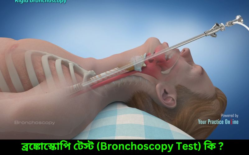 ব্রঙ্কোস্কোপি টেস্ট (Bronchoscopy Test) কি ?